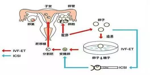 中国单身女性辅助生殖技术准入现状